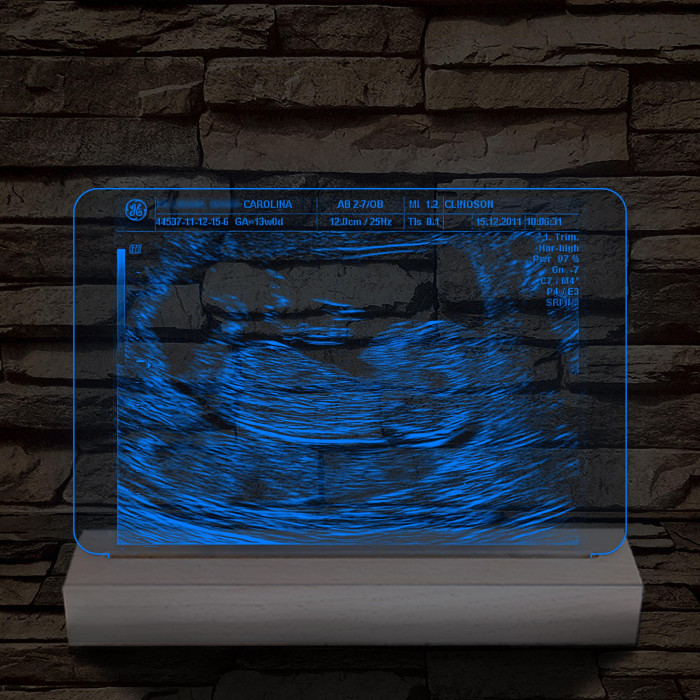 Magzati-ultrahangkép gravírozás fatalppal 7 színű 3D led lámpa