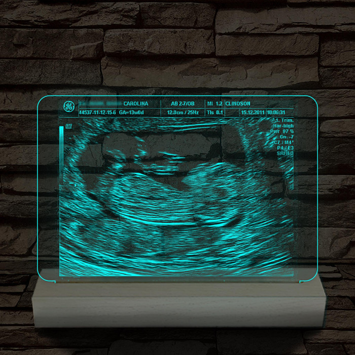 Magzati-ultrahangkép gravírozás fatalppal 7 színű 3D led lámpa
